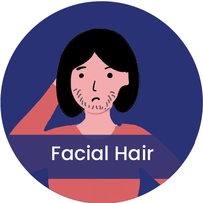 facial hair - symptom of post-pill type of PCOS
